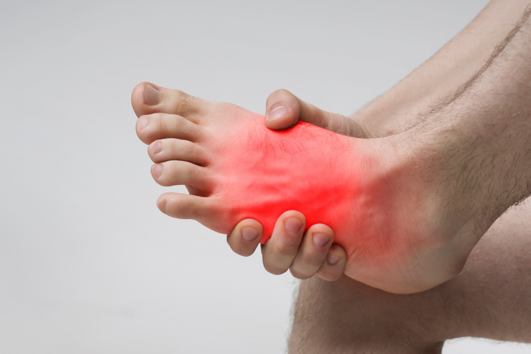 Plantillas para fascitis plantar en Concepción — alivio del dolor de talón con Footline