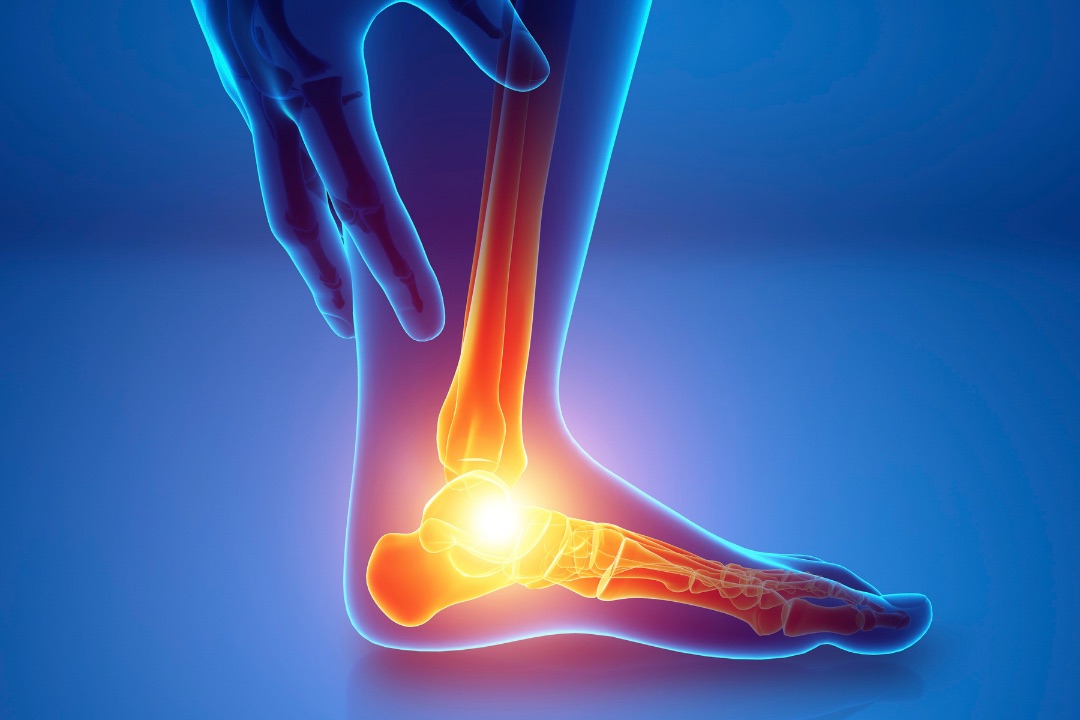 Anatomía de la fascia plantar: por qué la fascitis plantar produce dolor de talón
