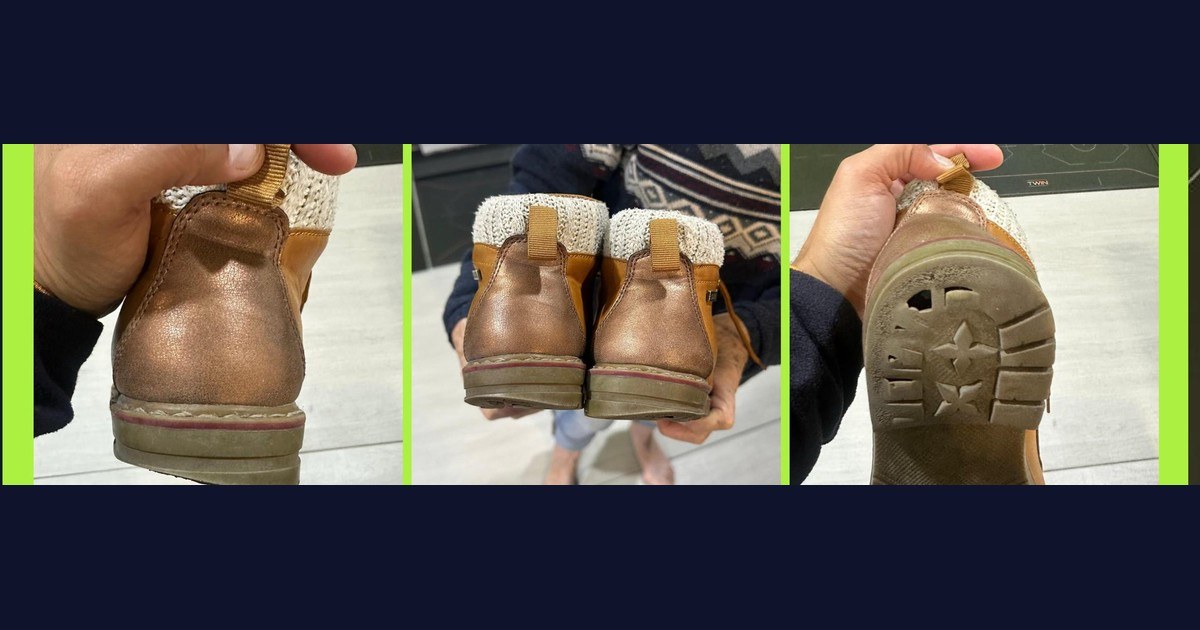 Zapatos con desgaste y deformación hacia el lado interno observados en consulta